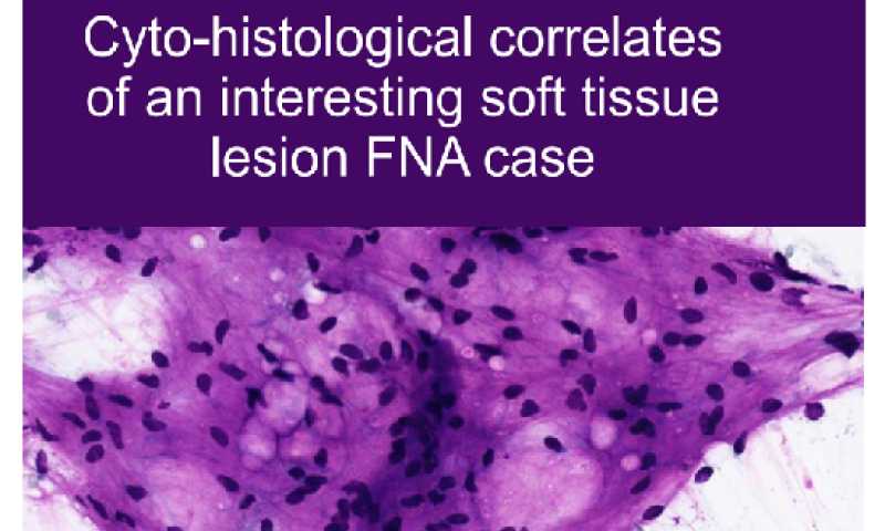 February 2023 Case study - Cyto-histological correlates of an interesting soft tissue lesion FNA case