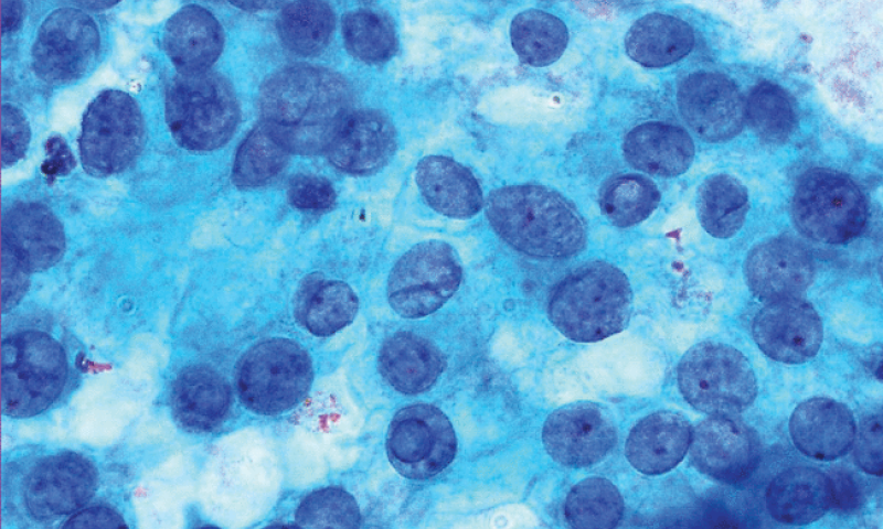 What’s in January’s Cytopathology?