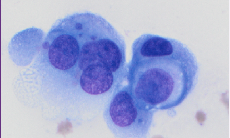 May 2023 Case Study - When morphology and immunocytochemistry align