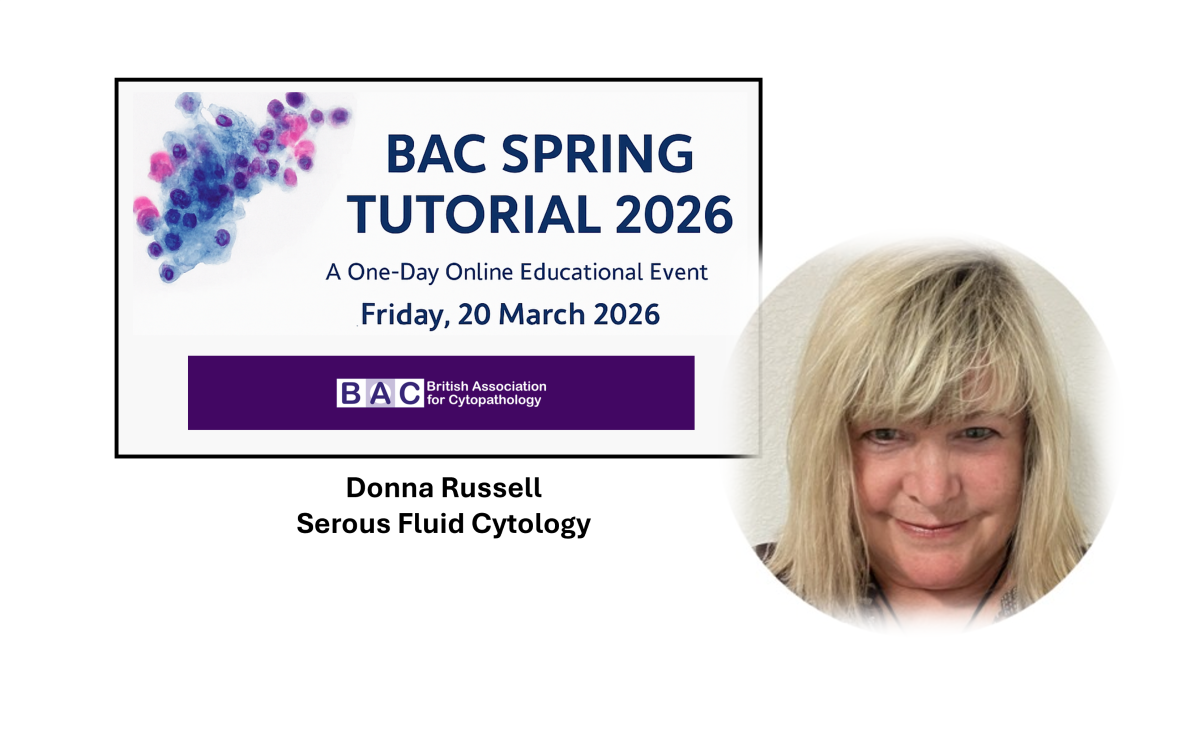 Donna web serous fluid