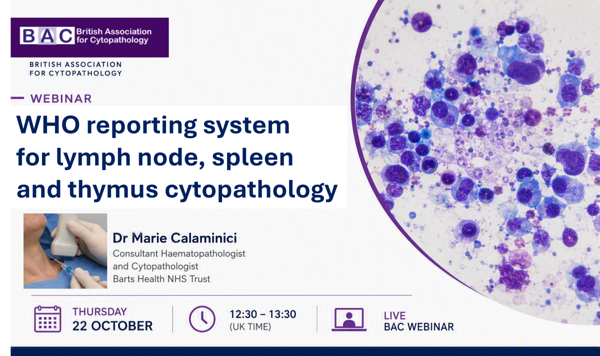 Lymph node webinar