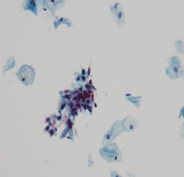 Case image 2