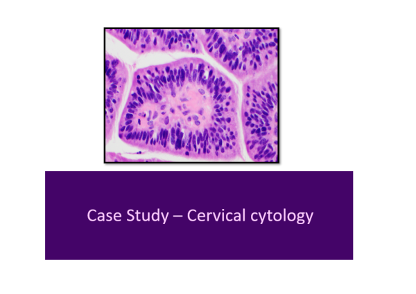 Cervical case study