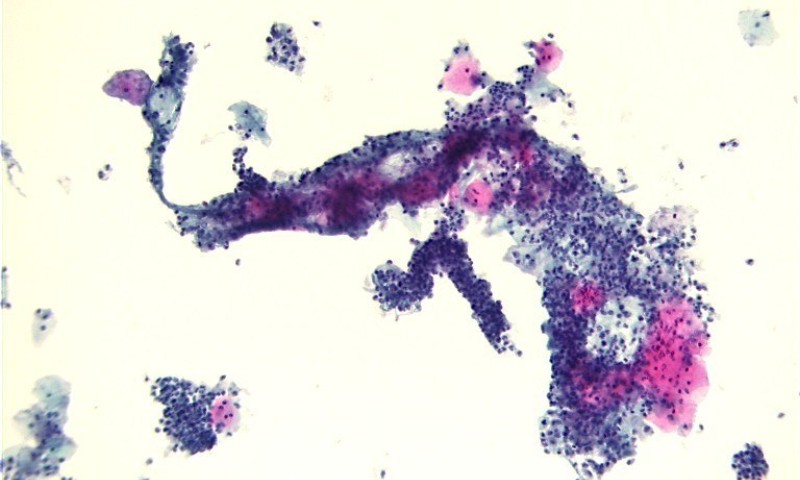 June 2025 Image of the Month - As proud as a peacock