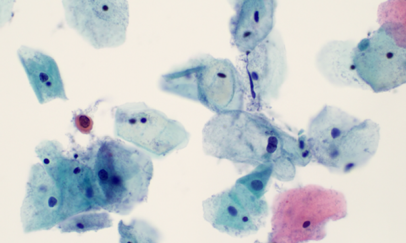 BAC Lunchtime Slide Club: Cervical Cytology in Focus 30th July 2025