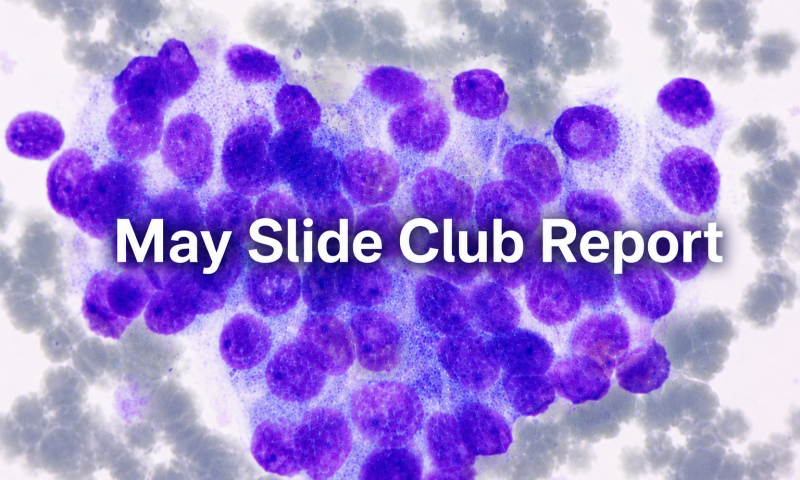 BAC Slide Club Review - May 2026