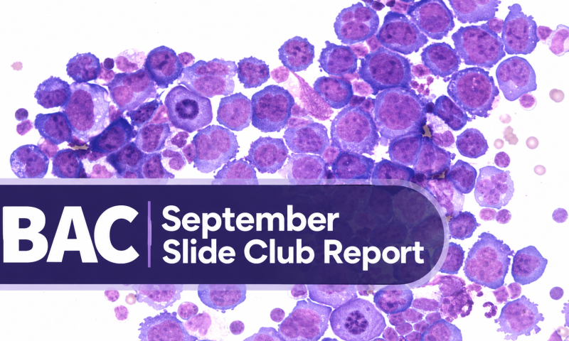 September Slide Club Report