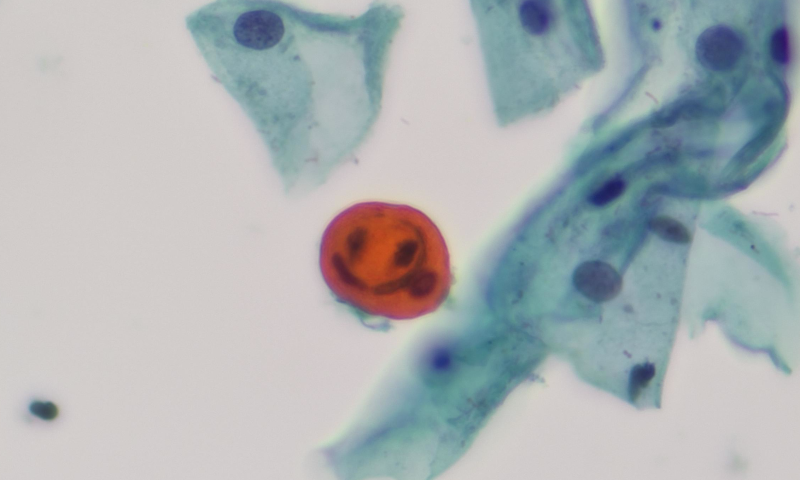 October 2025 Image Of The Month - Cheeky Pumpkin
