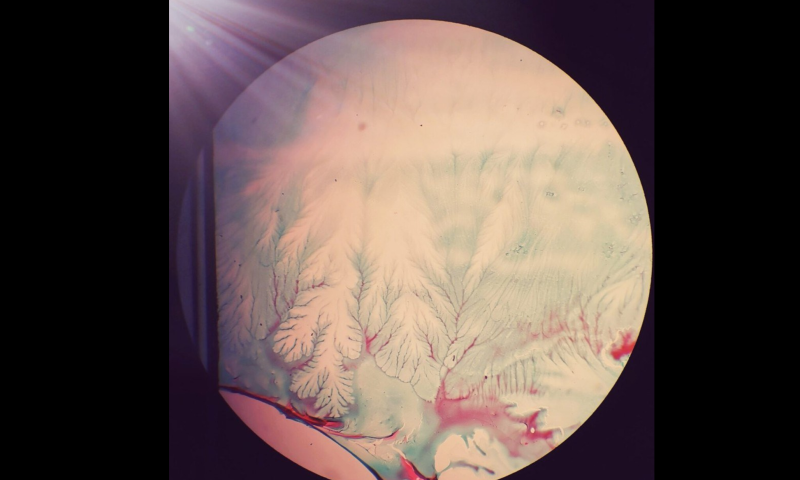 August 2025 Image of the Month - The sun shines upon the colloid forest