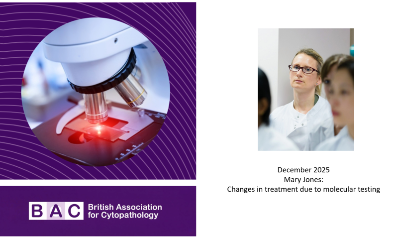 Watch again! Changes in treatment due to molecular testing - Mary Jones