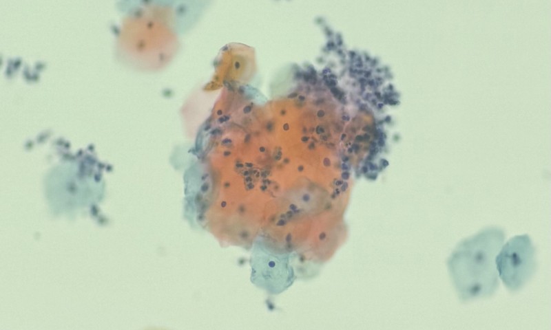 December Image of The Month Winner - Turkey!