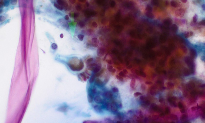 July 2025 Image of the Month - Bad kind of fruit