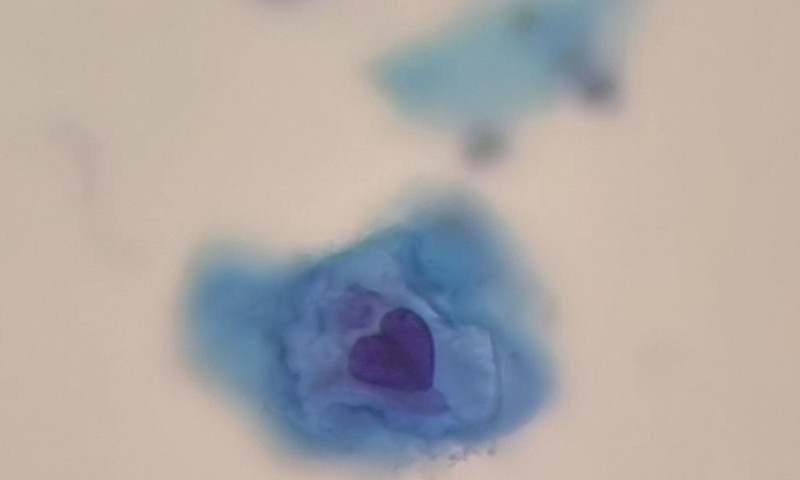 Love Heart Nucleus