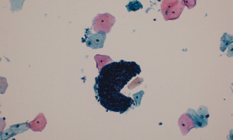 Polymorph Pacman