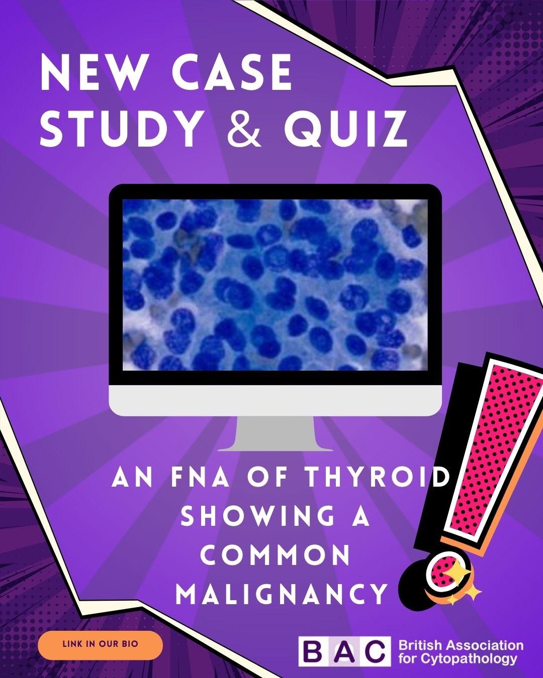 Instagram Templates 5